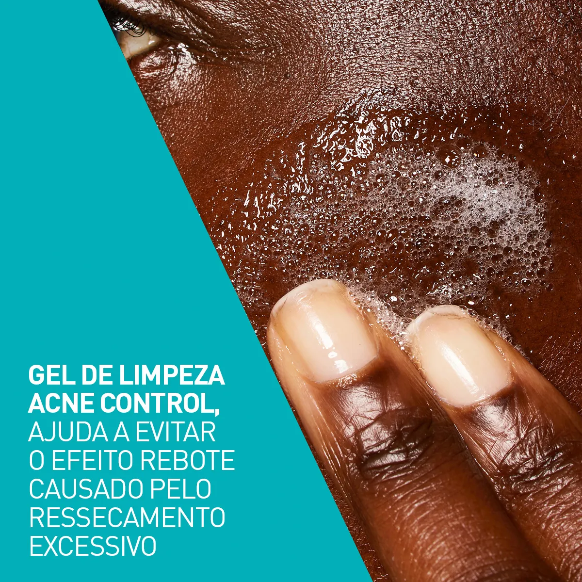 Imagem 12 de 12 de Gel De Limpeza Acne Control 340g Cerave Para Pele oleosa a acneica de Dia e Noite