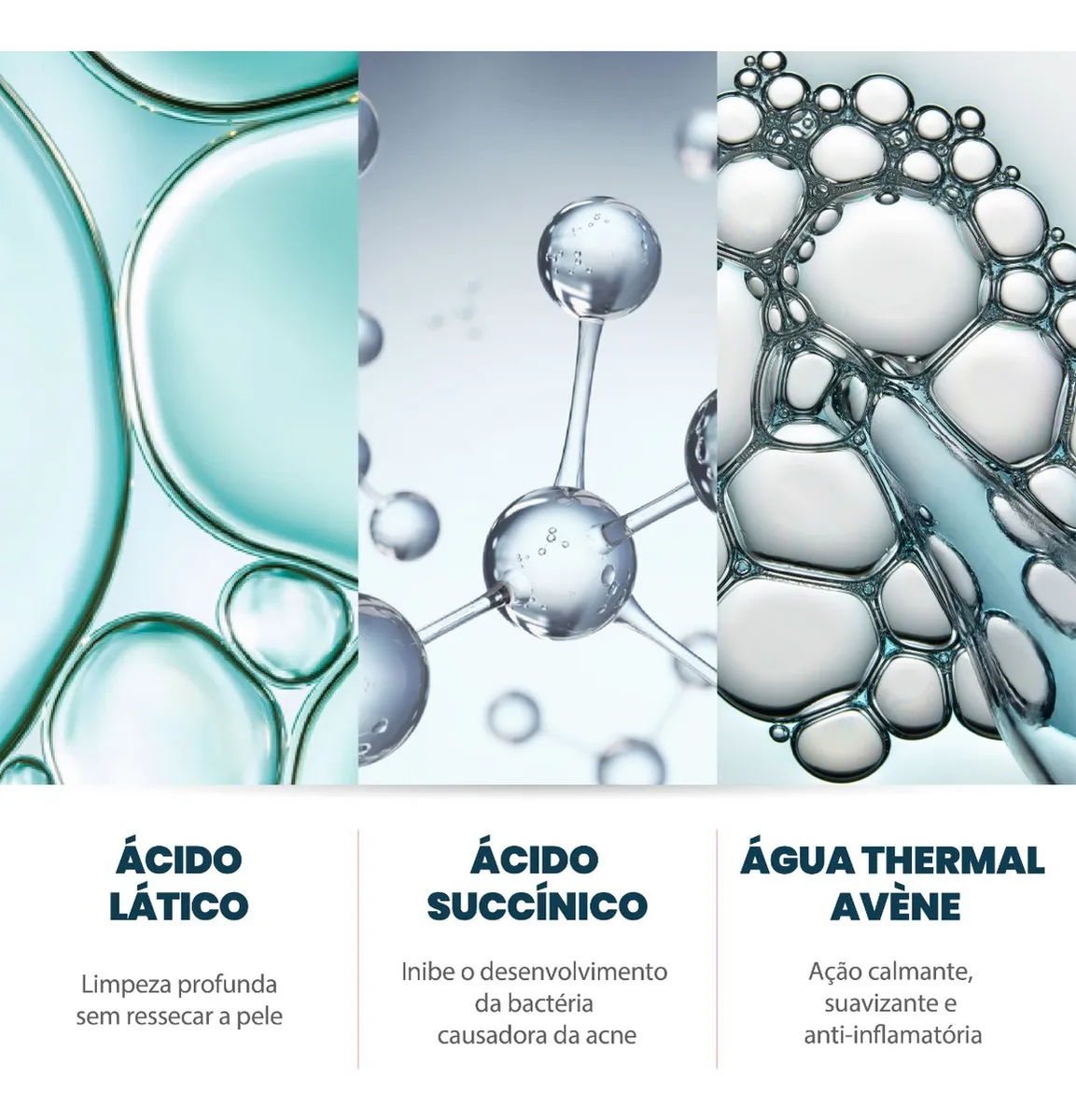 Imagem 6 de 8 de Avène Cleanance Intense - Gel De Limpeza Profunda 400g Tipo de pele Oleosa