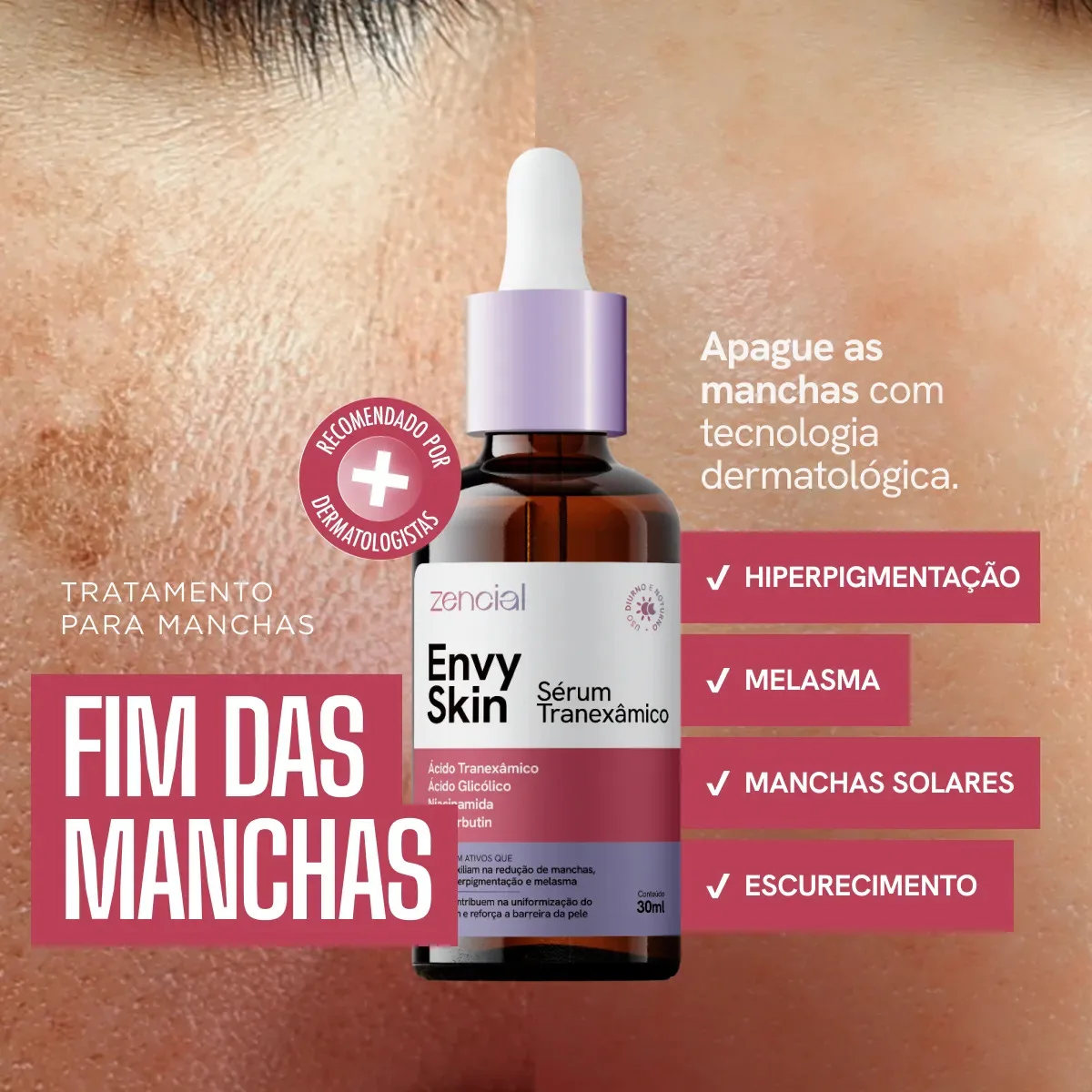 Sérum Envy Skin Ácido Tranexâmico Clareador Manchas e Melasma Profundo 30 mL Zencial