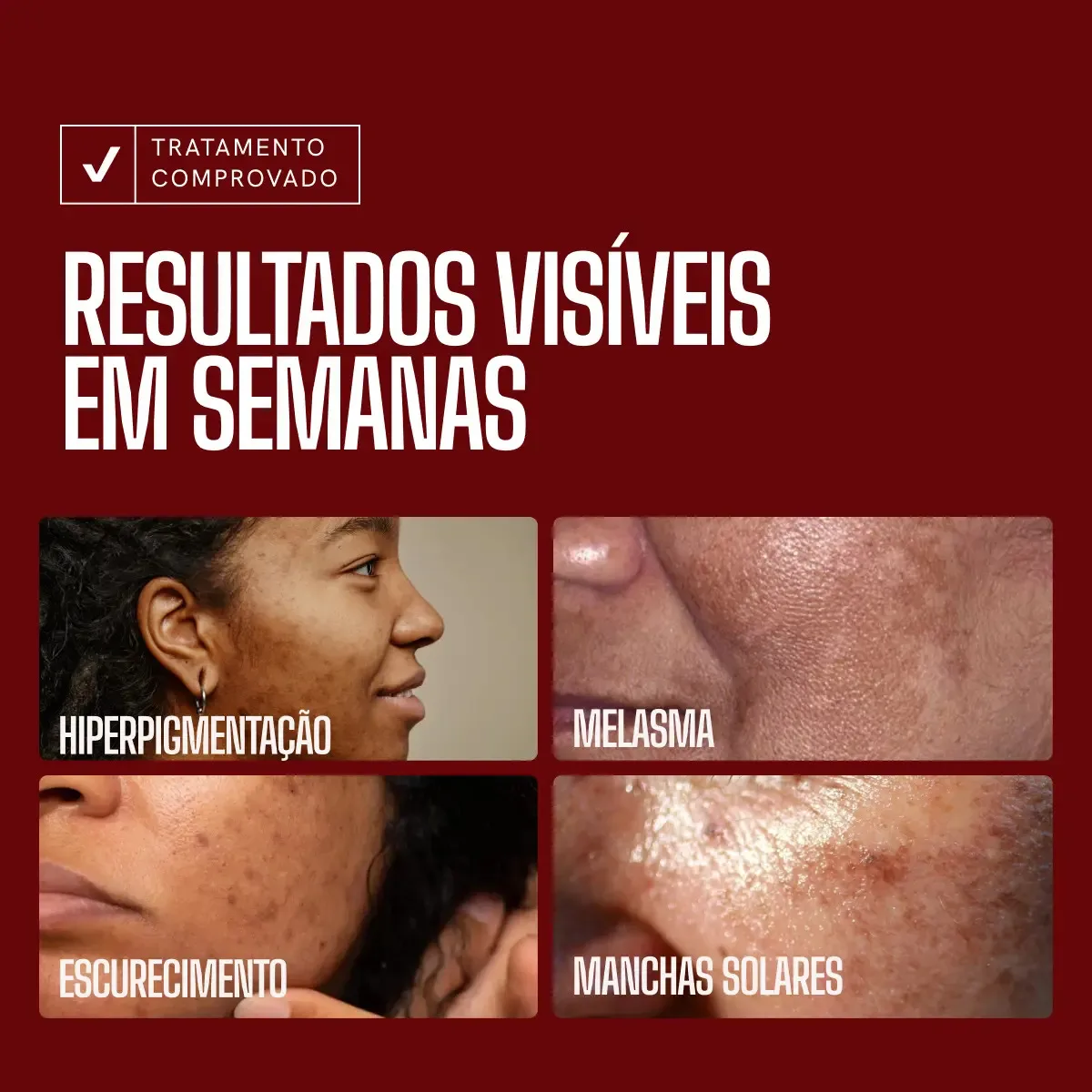 Sérum Envy Skin Ácido Tranexâmico Clareador Manchas e Melasma Profundo 30 mL Zencial