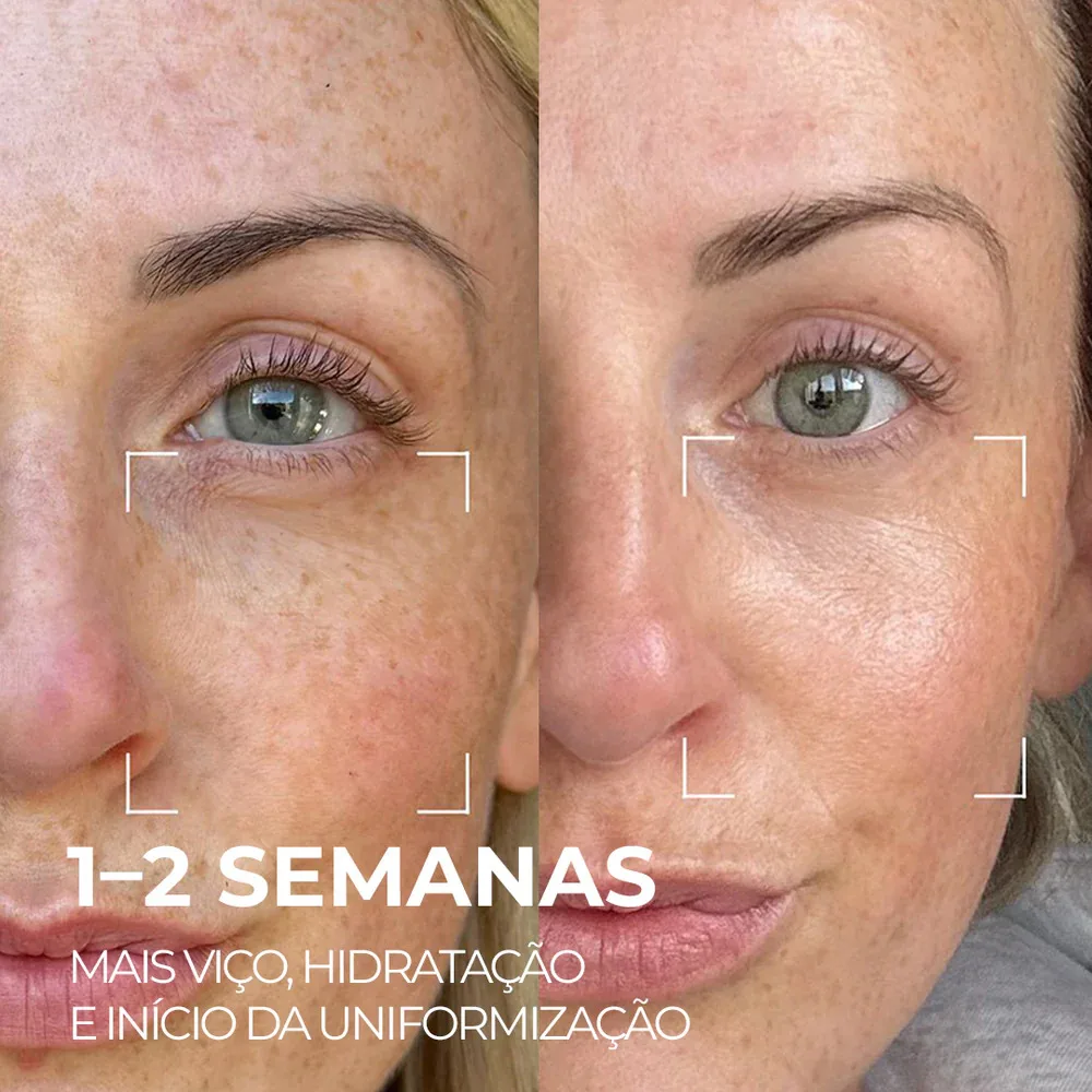 Serum Facial Visage Dor - Saviora Skincare Manchas