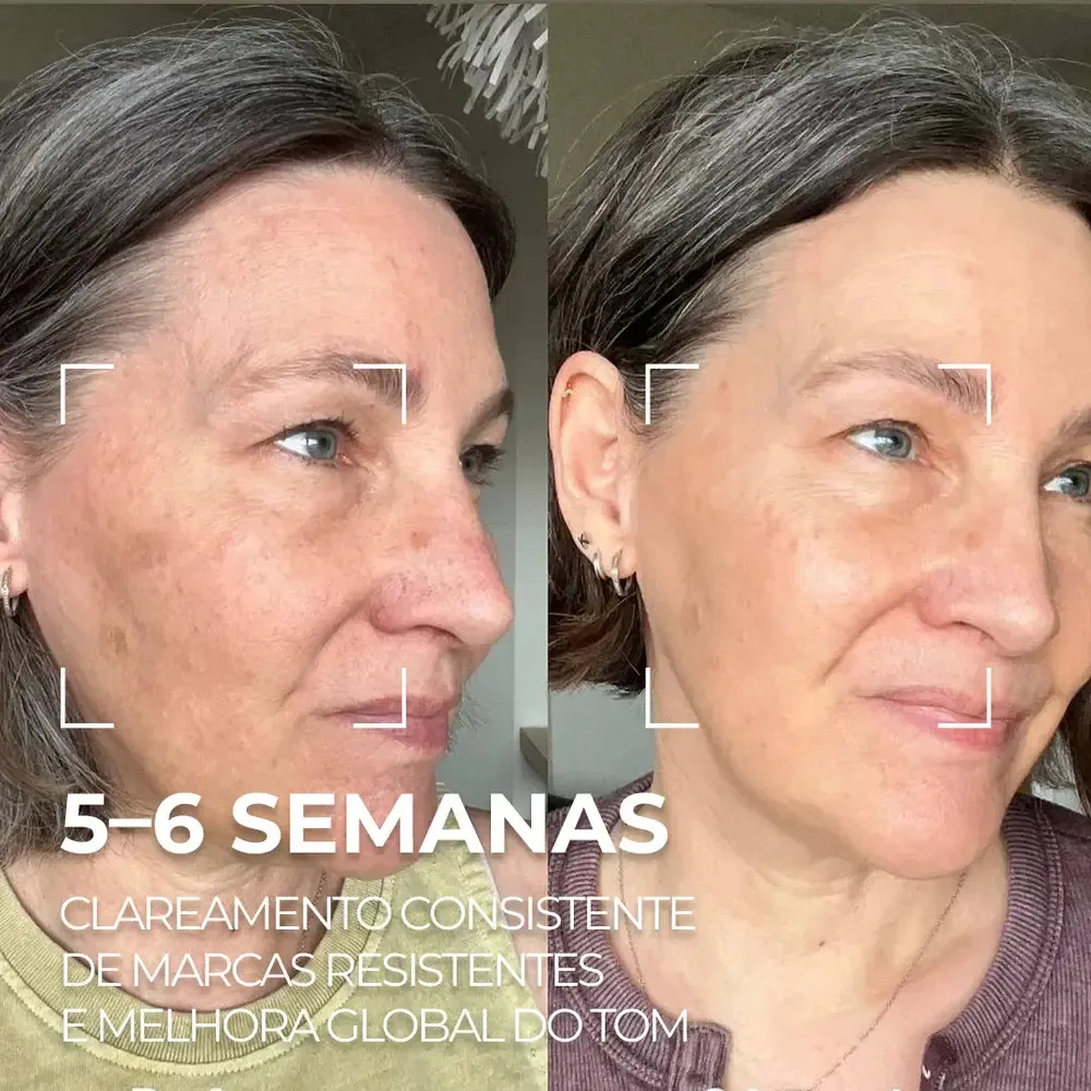 Serum Facial Visage Dor - Saviora Skincare Manchas