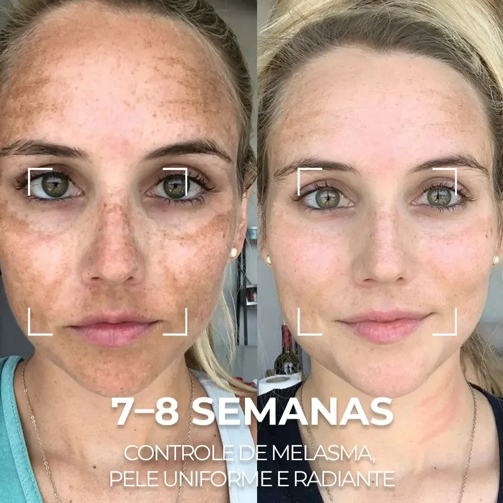 Serum Facial Visage Dor - Saviora Skincare Manchas