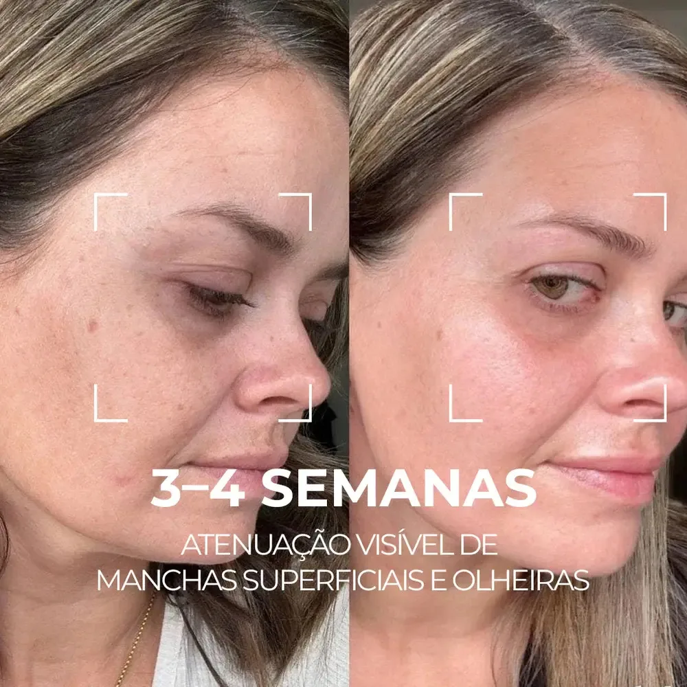 Serum Facial Visage Dor - Saviora Skincare Manchas